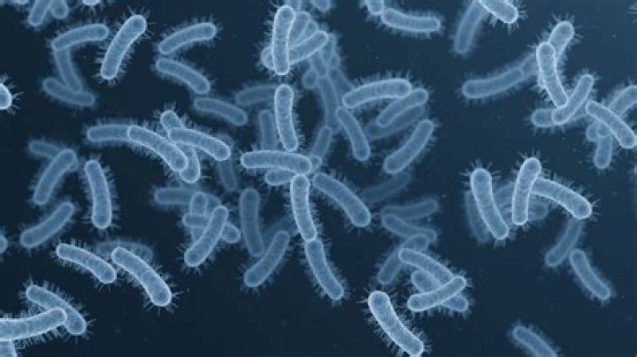 What color is Shigella