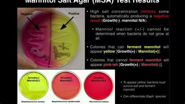 What does MSA test for